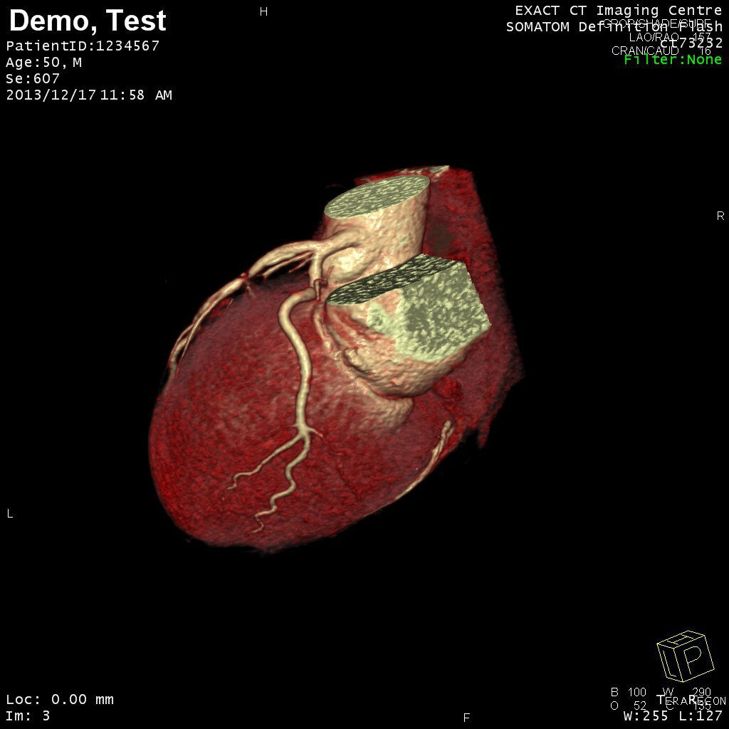 CT Scan Images EXACT Medical Group